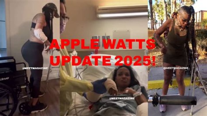 Tragic Apple Watts Accident: Uncovering The Devastating Impact
