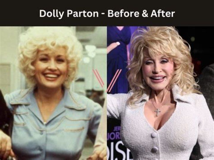 Dolly Parton's Boobs Authenticity Revealed