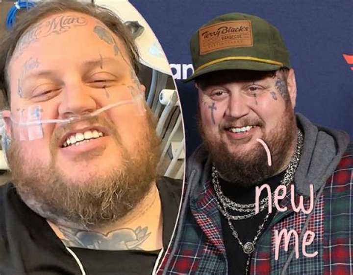 Are Jelly Roll's Teeth Rotten?