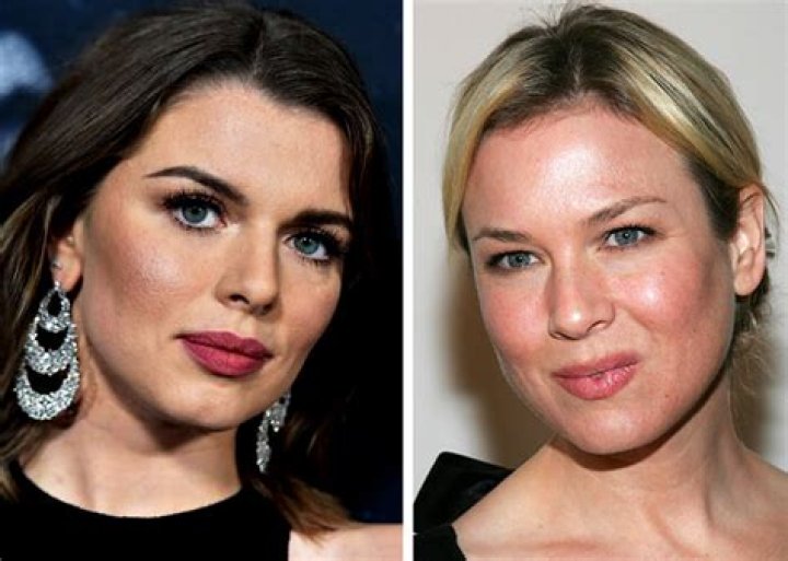 Unveiling The Faces Behind Rosacea: Celebrities' Stories And Surprises