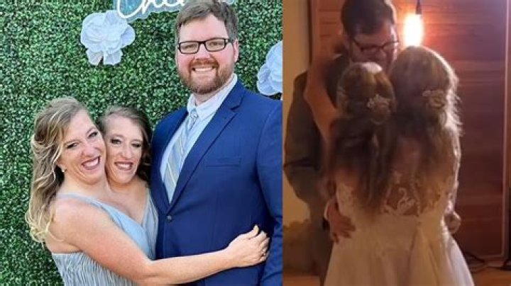 Conjoined Twins Abby And Brittany Hensel's Pregnancy Journey