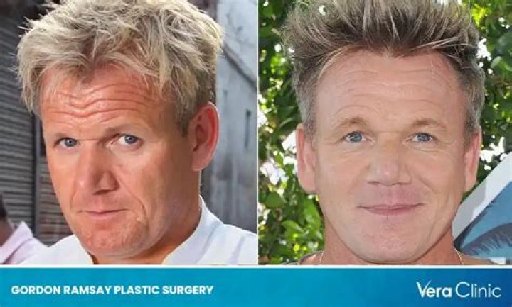 Gordon Ramsay's Facial Hair: A Culinary Icon's Distinctive Look