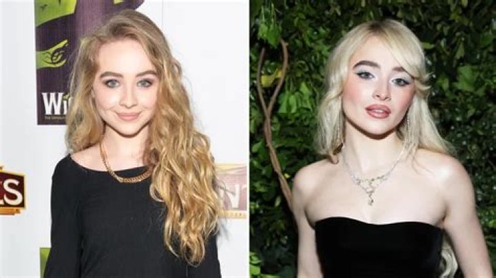 The Truth Unveiled: Is Sabrina Carpenter's Transformation Plastic Surgery Or Just Good Genes?