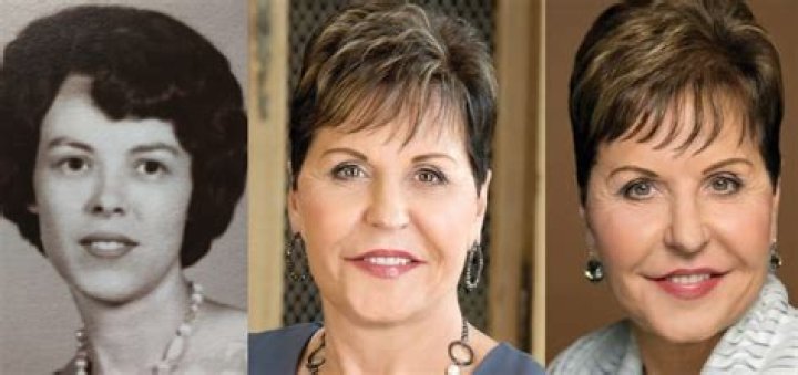Unveiling Joyce Meyer's True Face: Before The Knife