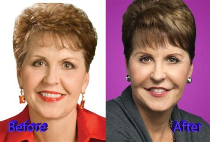 Discover Joyce Meyer's Lip Secrets: Essential Tips And Tricks