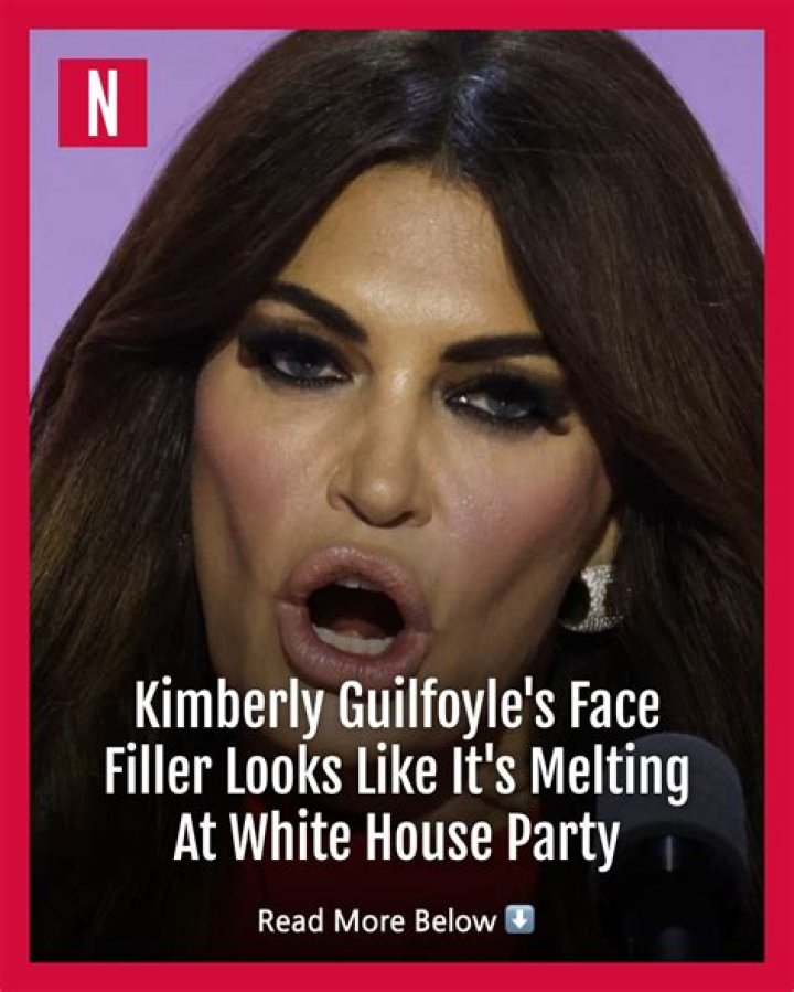 Kimberly Guilfoyle's Facial Enhancements: A Comprehensive Guide