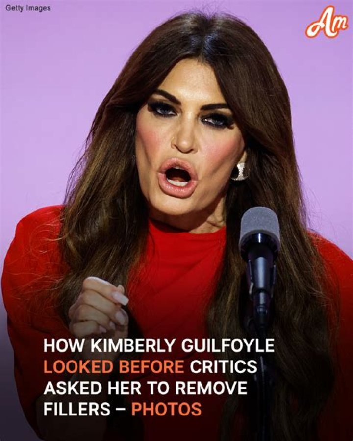 The Truth About Kimberly Guilfoyle's Fillers Revealed