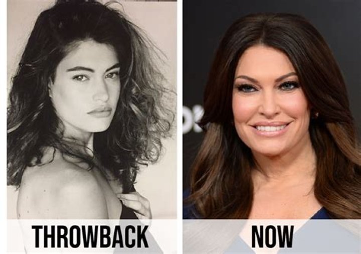 Kimberly Guilfoyle's Plastic Surgery: Unlocking Secrets And Revelations