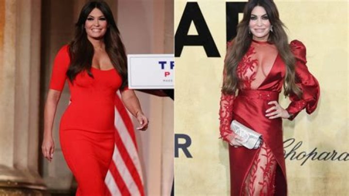 Unveiling Kimberly Guilfoyle's Journey: The Weight Loss Surgery Transformation