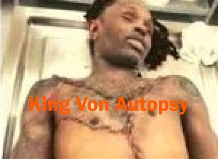 Unveiling The Truth: King Vin Autopsy Photos Revealed