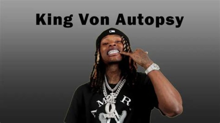 King Von Autopsy: Uncovering The Tragic Loss