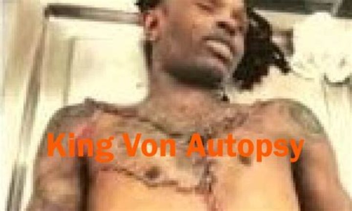Tragic Details Revealed: King Von's Leaked Autopsy Uncovered