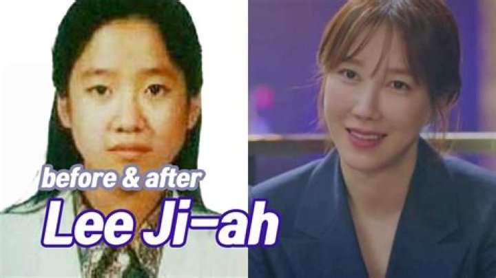 Unveiling Lee Ji-Ah: A Look At Her Life Before Surgery