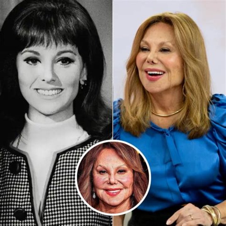 Uncover The Truth Behind Marlo Thomas's Facelift Journey