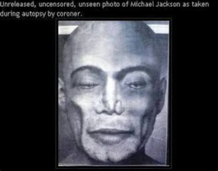 Unveiling The Secrets: The Autopsy Report Of Michael Jackson