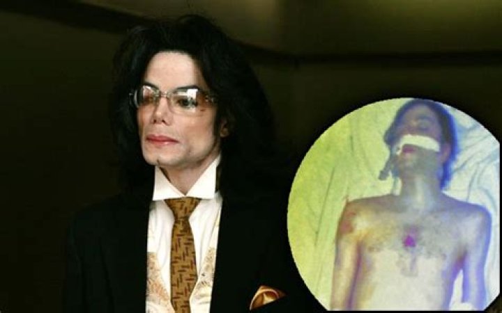 The Unseen Truth: Uncovering The Secrets Of MJ's Autopsy