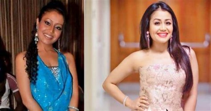 Unveiling The Truth: Neha Kakkar's Plastic Surgery Journey