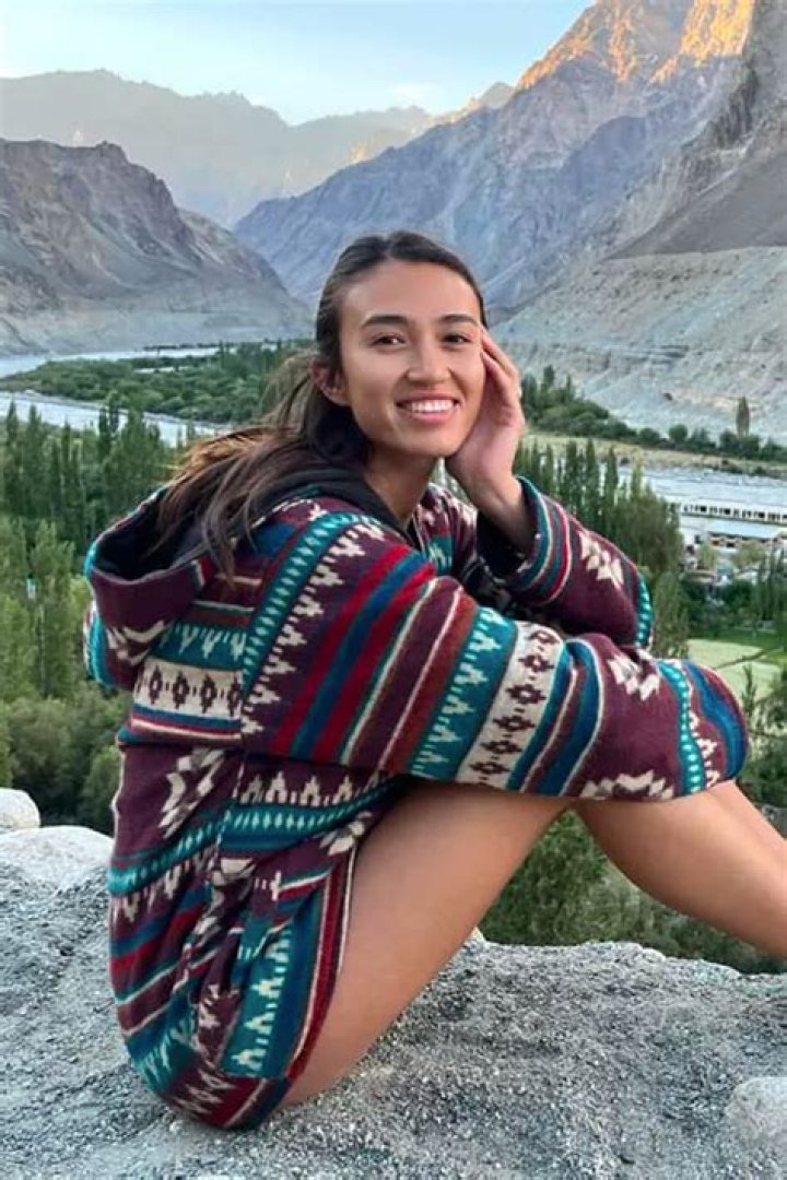 Astonishing Incident Involving Noa Argamani: A Shocking Case Of Burns