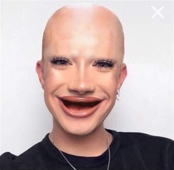 Celebrating Baldness: A Visual Tribute To Bald People