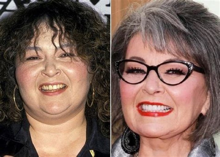 Transformations Of A Comedian: Roseanne Before And After Plastic Surgery