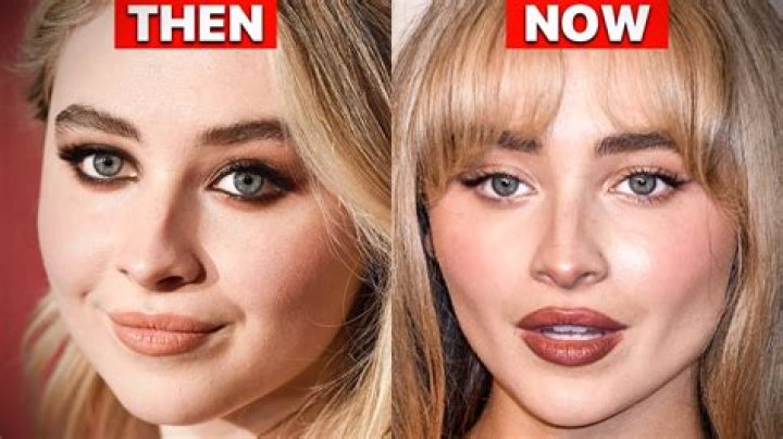 Sabrina Carpenter's Face Surgery: A Detailed Guide