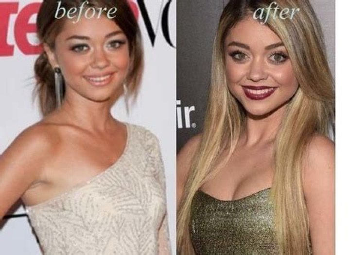 Unveiling Sarah Hyland's Plastic Surgery Journey: Discoveries And Insights