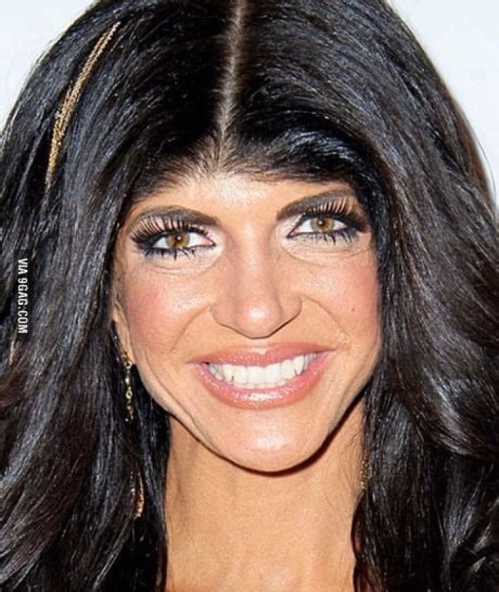 Uncovering The Individual With The World's Diminutive Forehead